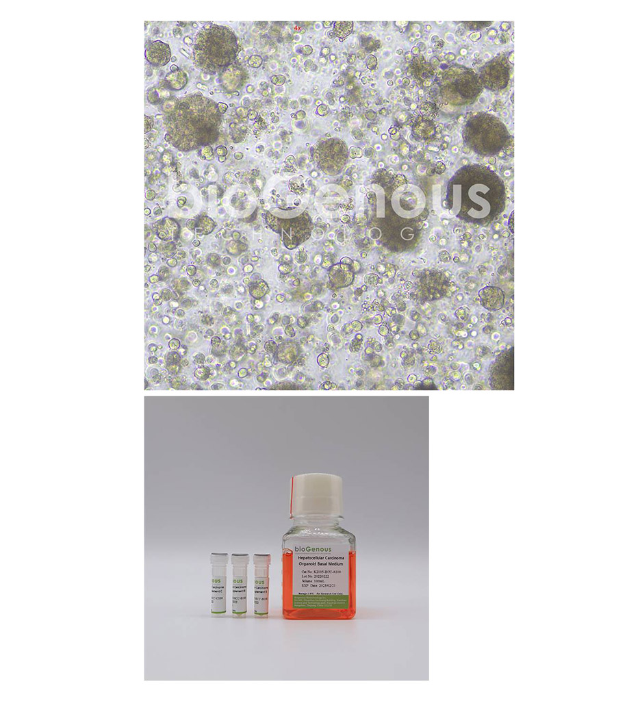 Hepatocellular Carcinoma Organoid Kit肝实质细胞癌