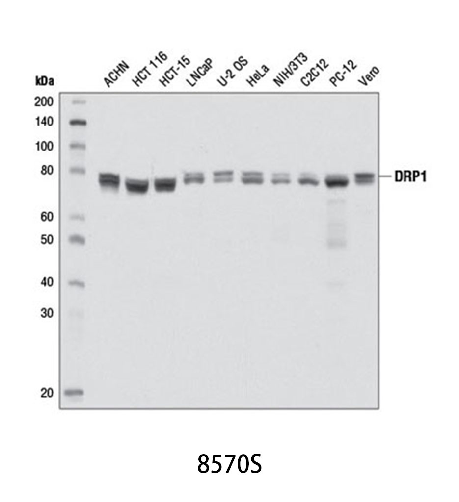 DRP1 (D6C7) Rabbit mAb