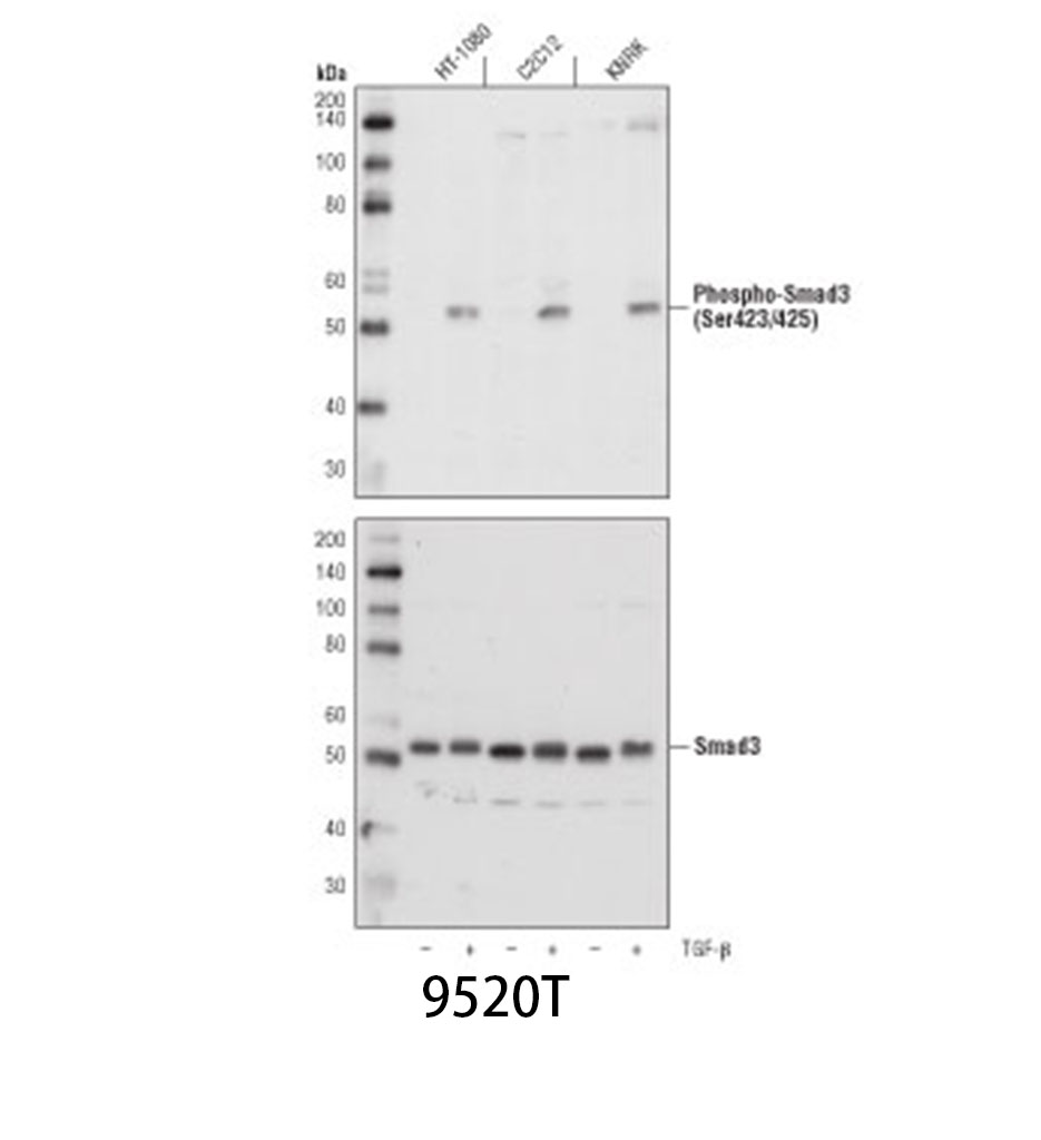 Phospho-Smad3 (Ser423/425) (C25A9) Rabbit mAb