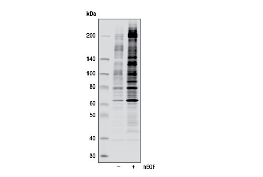 Phospho-Tyrosine (P-Tyr-1000) MultiMab Rabbit mAb mix