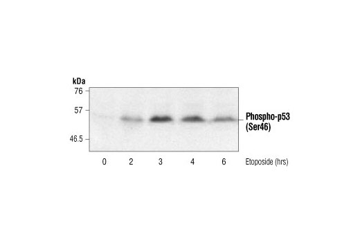 p53 Antibody Sampler Kit