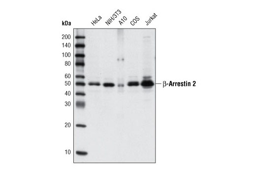 β-Arrestin 2 (C16D9) Rabbit mAb