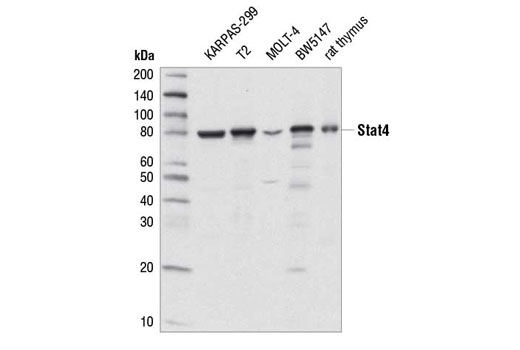 Stat4 (C46B10) Rabbit mAb