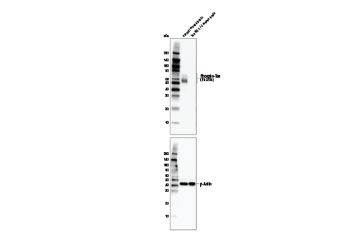 Phospho-Tau (Thr205) (E7D3E) Rabbit mAb