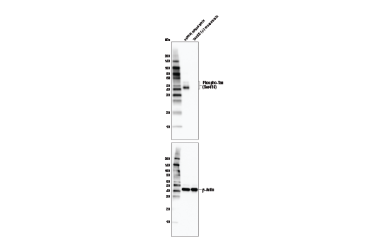 Phospho-Tau Family Antibody Sampler Kit