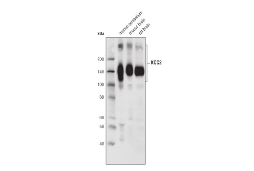 KCC2 (D1R2R) Rabbit mAb