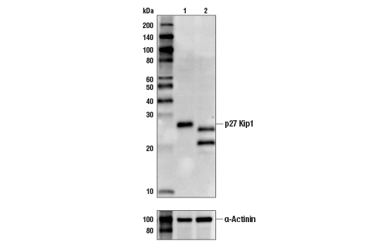 p27 Kip1 (SX53G8.5) Mouse mAb