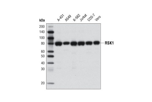 RSK1 (D6D5) Rabbit mAb