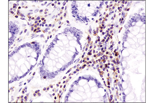 CXCR4 (D4Z7W) Rabbit mAb (IHC Specific)