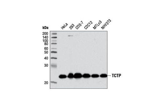 TCTP (D10F2) Rabbit mAb