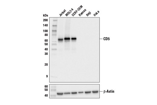 CD5 (E8X3S) XP Rabbit mAb