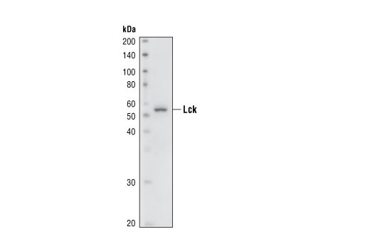 Lck (73A5) Rabbit mAb