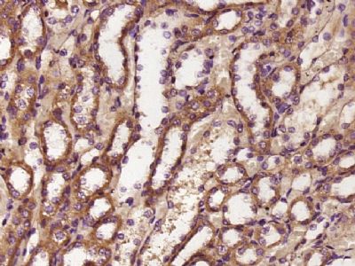 含锚蛋白重复序列-细胞因子信号抑制物盒蛋白家族5抗体