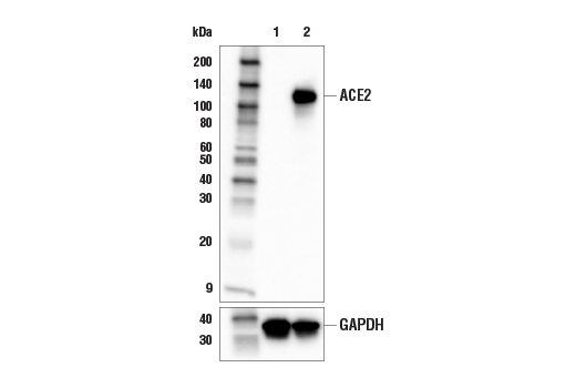 ACE2 (E5O6J) Rabbit Monoclonal Antibody