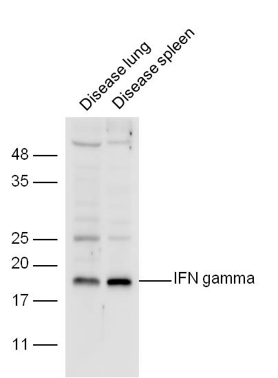 干扰素-K/IFN-r抗体
