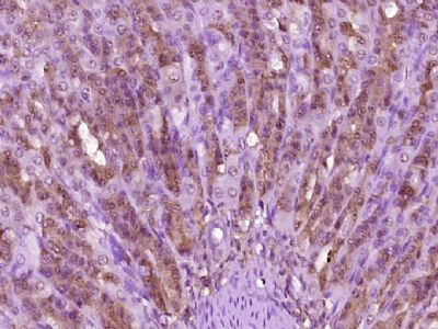 巨核细胞刺激因子/蛋白多糖4/浅表层粘膜蛋白多糖抗体