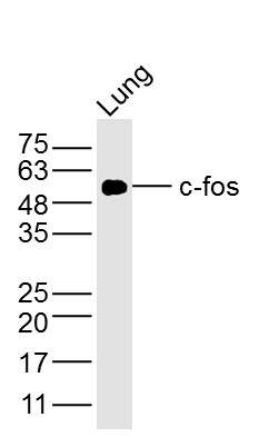 c-fos单克隆抗体