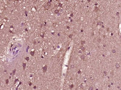 锌指蛋白683抗体