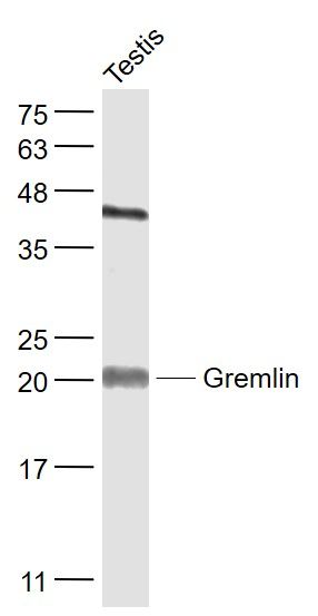 骨形态形成蛋白拮抗蛋白抗体