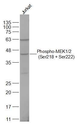 磷酸化丝裂原活化蛋白激酶激酶1/2抗体