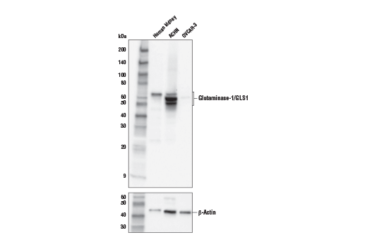 Glutaminase-1/GLS1 (E9H6H) XP Rabbit mAb