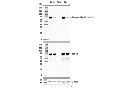 Phospho-SLP-76 (Ser376) (E3G9U) XP Rabbit mAb