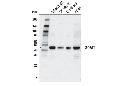 SOAT1 Antibody