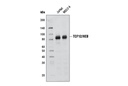 TCF12/HEB (D2C10) Rabbit mAb
