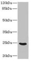 Anti-FGF19 antibody